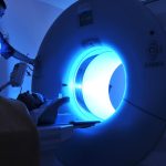 Political News: MRI screening for women with extremely dense breast tissue reduces interval cancer – CNN