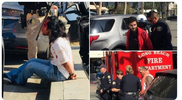 Trump fan hit with scooter as protest outside California Democrats convention turns violent: report