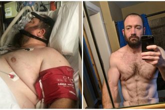 Fox News Today: Iowa man sheds half his body weight after invasive spinal surgery, says he once ate ‘with no constraint’