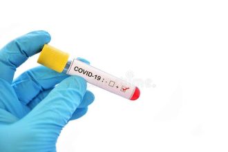 Health service awaits COVID-19 results of 4 contact person