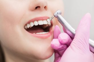 Routine Dental Care