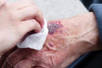 What Should Be Done Immediately After a Slip And Fall Accident