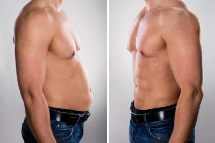 Tips To Enhance Liposuction Recovery
