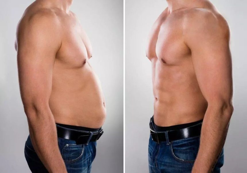 Tips To Enhance Liposuction Recovery