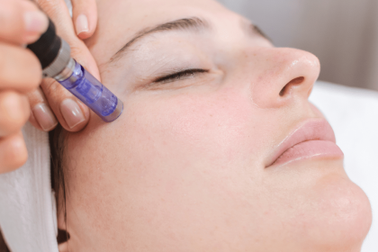 Microneedling Versus Laser Treatments, Which One Is Better For Your Skin?