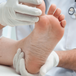 bunion surgery