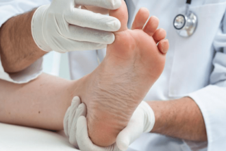 bunion surgery