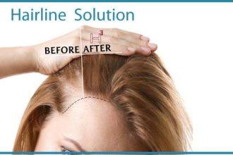 Haircubed's bald spot solution