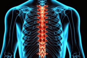 How Spinal Cord Injuries Can Be Life-Threatening After an Accident