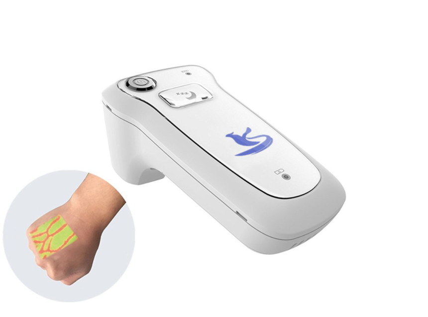 Locating Difficult Veins For Venipuncture Is Made Easy With A Vein Finder