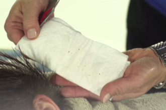 What do Nits look like on Paper towels
