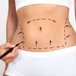 Pros Of Liposuction