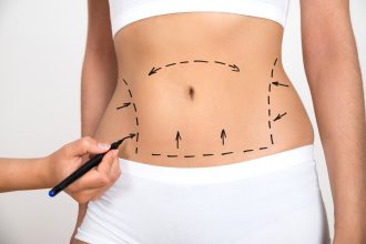 Pros Of Liposuction