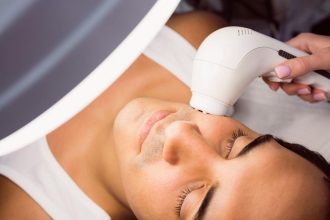 IPL light treatment