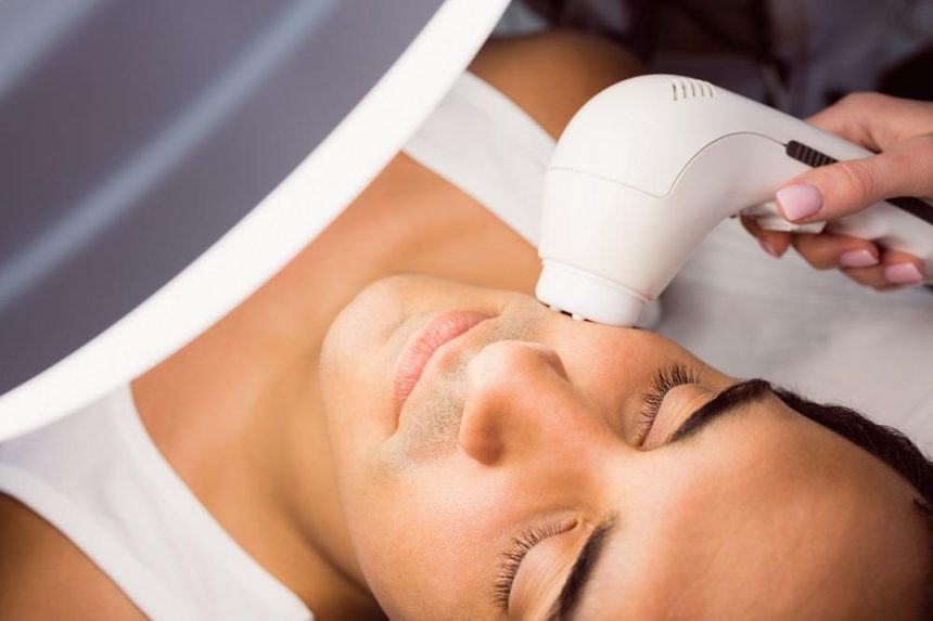 IPL light treatment