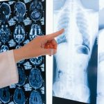 7 Tips to Get the Best Settlement for a Catastrophic Injury