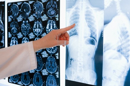 7 Tips to Get the Best Settlement for a Catastrophic Injury