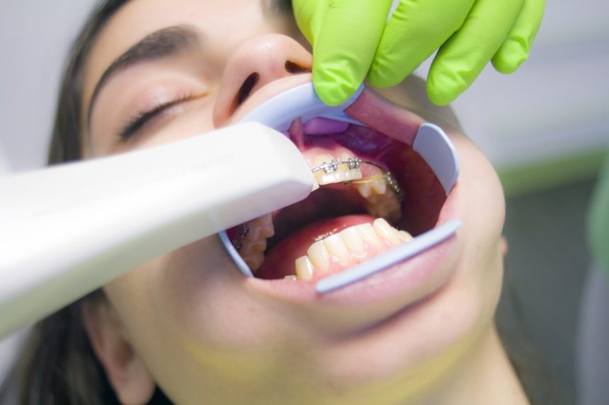 Taking Care of Your Teeth: Simple Habits for Optimal Dental Health