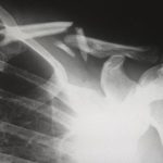 The Role of Medical Evidence in California Personal Injury Cases: An Overview