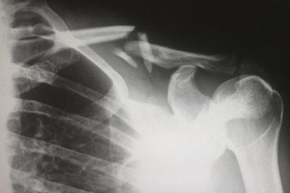 The Role of Medical Evidence in California Personal Injury Cases: An Overview