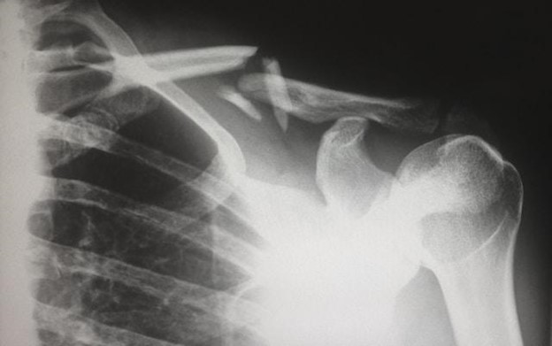 The Role of Medical Evidence in California Personal Injury Cases: An Overview