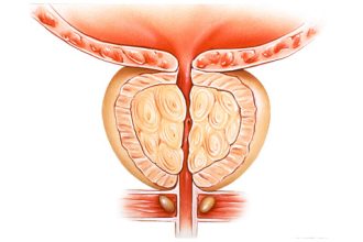 Effectiveness of Dutasteride and Finasteride for Benign Prostatic Hyperplasia