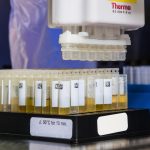Common Health Problems That Your Pee Sample Can Reveal