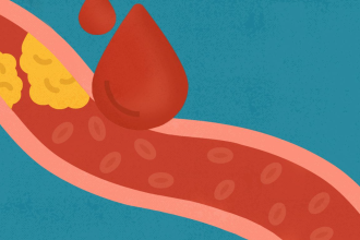 The Impact of High Cholesterol on Men