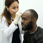 https://thenewsgod.com/how-afro-textured-hair-transplants-are-performed/