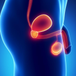 Why is it so important to seek a reliable surgeon for vasectomy reversal?