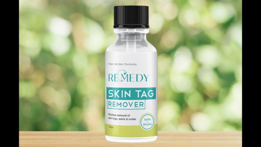 What you should know about Utopia Skin Tag Remover.