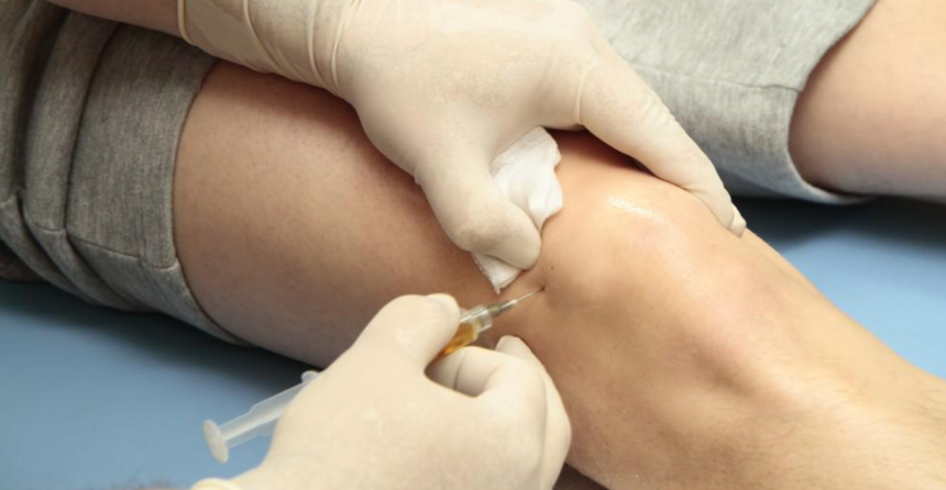 Unlocking Athletic Potential: The Impact of PRP on Performance