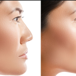 The Future of Dubai as a Cosmetic Surgery Destination
