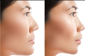 The Future of Dubai as a Cosmetic Surgery Destination
