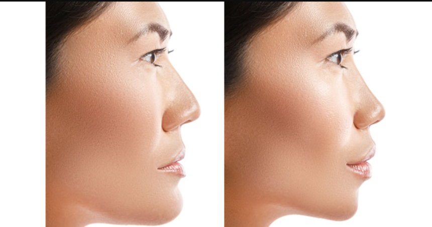 The Future of Dubai as a Cosmetic Surgery Destination