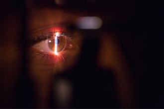 Ways to Find Clarity: Your Guide to Lasik and Astigmatism Treatment