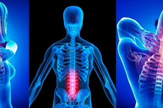 9 Essential Signs Indicating the Need for Chiropractic Care in East Perth