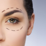 Understanding Double Eyelid Surgery: Its Significance and Process