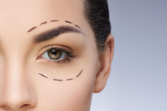 Understanding Double Eyelid Surgery: Its Significance and Process