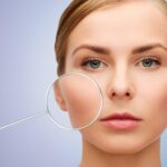 How Pigmentation Removal Cream Can Help Fade Them Away From Sun Spots to Age Spots