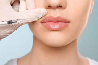 Benefits and Considerations of Dermal Fillers: What You Need to Know