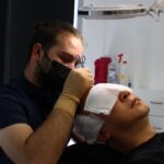 Art Line Hair Clinic: Turkish Innovation in Tijuana