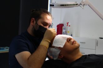 Art Line Hair Clinic: Turkish Innovation in Tijuana