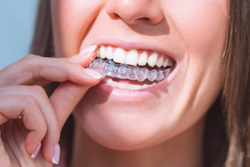 What to Expect When Getting Braces: A Beginner’s Guide
