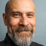 The Evolution of Hair Restoration: How FUE Hair Transplants Have Revolutionized the Industry