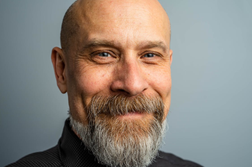 The Evolution of Hair Restoration: How FUE Hair Transplants Have Revolutionized the Industry