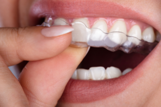 Achieve a Perfect Smile: How Clear Aligners Work and What to Expect