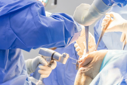 The Advantages of Arthrex’s Surgical Solutions in Today’s Healthcare