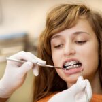 The Benefits of Teeth Alignment for Overall Health