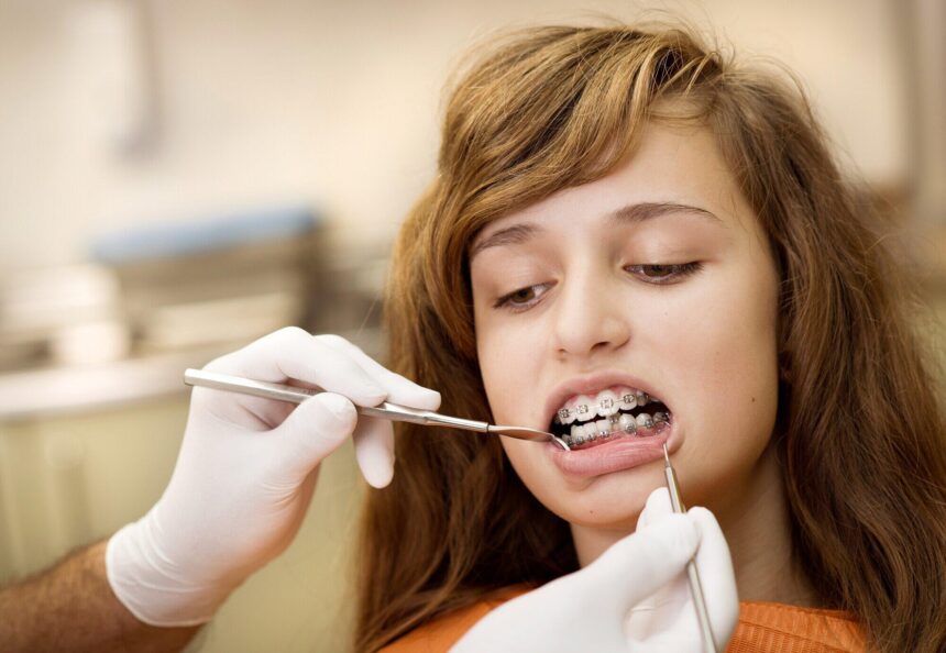 The Benefits of Teeth Alignment for Overall Health